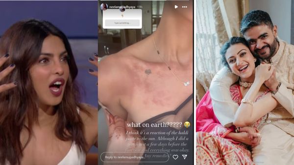 प्रियंका चोपड़ा के भाई की शादी के बाद भाभी ने दी बुरी खबर, दर्दनाख तस्वीरें शेयर कर खुलेआम मांग रही मदद