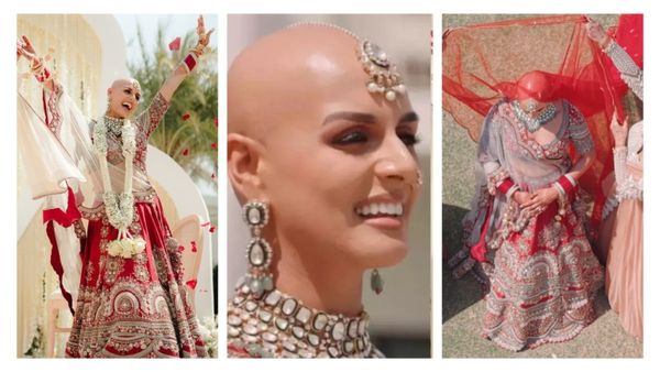 Video: गंजी दुल्हन के सिर से जब हटा पल्लू,फुदक गया दूल्हे का कलेजा... जानिए क्या है Alopecia बीमारी