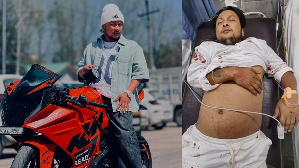 पवनदीप राजन की हालत स्थिर, कई सर्जरी के बाद भी है दुआओं की जरूरत