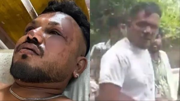 Ahmedabad Plane Crash में हुआ चमत्कार, बच निकला एक युवक, खुद सुनाई दिल दहला देने वाली आपबीती