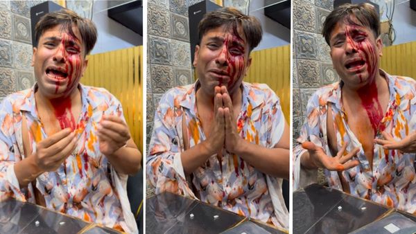 सिर फोड़ा, कपड़े फाड़े, खून से कर दिया लथपथ.. Puneet Superstar की बुरी तरह पिटाई? रो रोकर बताई दास्तां!