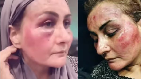 एक्ट्रेस की प्रॉपर्टी हड़पना चाहता था पति, सबके सामने बाल खींचे, गालियां दी, बंदूक डालकर तोड़ा जबड़ा