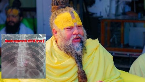 Fact Check: प्रेमानंद महाराज के सीने का X-RAY हुआ वायरल, भगवान कृष्ण की तस्वीर देख दंग हैं लोग!