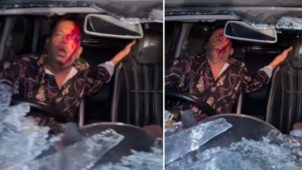 पुनीत सुपरस्टार का कार एक्सीडेंट? खून से लथपथ आए नजर, लोग बोले- 'कोई मत बचाना'