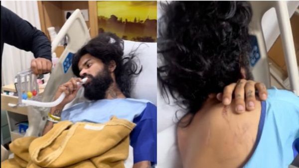 ऐसी हो गई है अनुराग डोभाल की हालत, UK007 राइडर के जख्म देख भर आया फैन्स का दिल