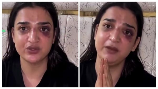 कराची में ट्रांसजेंडर के साथ हुई दरिंदगी, पीड़िता ने इंसाफ ना मिलने पर दी प्रशासन को धमकी!