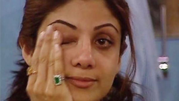 पीठ जल गई फिर भी शूटिंग की... शिल्पा शेट्टी ने किया चौंकाने वाला खुलासा, बताई उस रात की दर्दनाक कहानी