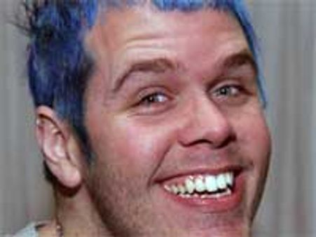 Perez Hilton allegedly beaten bloody by will.i.am