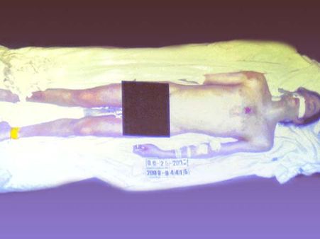 Michael Jackson's nude autopsy pictures emerges online