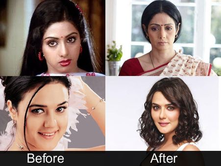 Priyanka, Shilpa, Sridevi, Bipasha, Kangana, Preity: Top plastic surgeries of Bollywood!