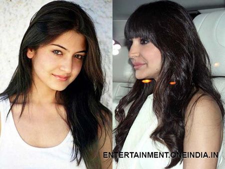 Anushka Sharma's Lip Job Upsets Fans