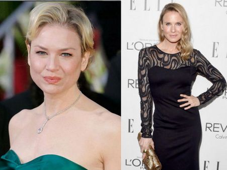 Guess Who Is This Actress? Its Renee Zellweger!!