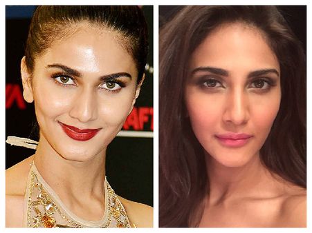 Vaani Kapoor Undergoes Lip Surgery To Boost Career?