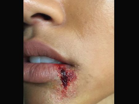 Did Chris Brown Assault Karrueche Tran? Fans React Over Mysterious Pic