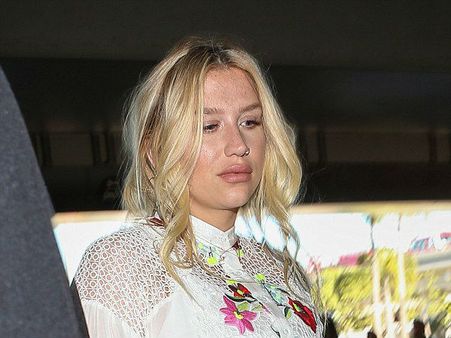 The 'Tik Tok' Singer Spotted With Fuller Lips : Did Kesha Get A Lip Job?