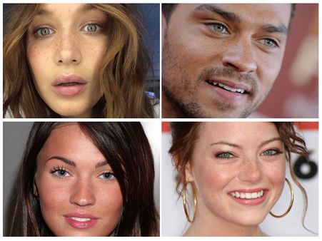 Fabulous Celebrities Who Embraced The Freckles On Their Face!