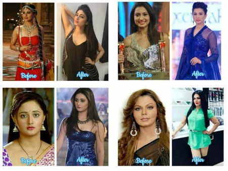 Mouni Roy, Gauhar Khan, Rashmi Desai & Other TV Actresses Who Went Under The Knife