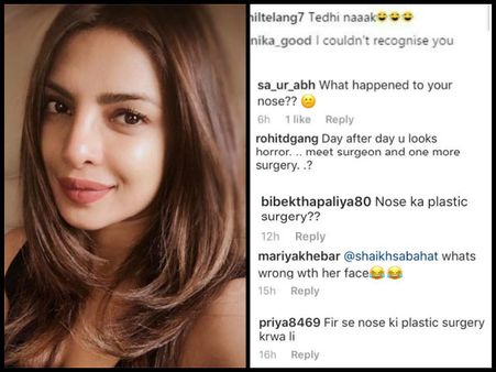 A Tale Of Plastic Surgery! Priyanka Chopra Gets Trolled Mercilessly For Her Alleged Nose Job!