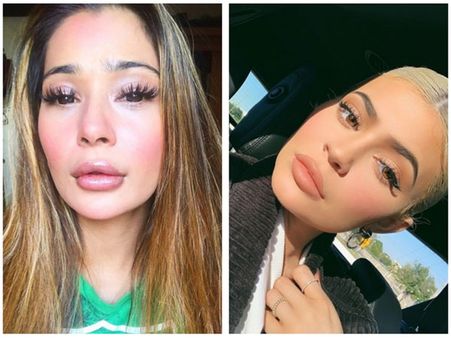 Lip Surgery Gone Wrong! Sara Khan Gets Trolled; Trollers Ask If She’s Trying To Copy Kylie Jenner!