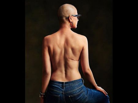 Tahira Kashyap's BOLD Picture On World Cancer Day Is Making Us Say, 'More Power To You, Girl'!