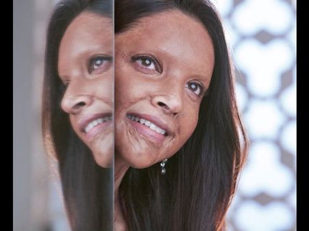 Ranveer Singh Drops A Comment On Wife Deepika Padukone’s First Look From Chhapaak!
