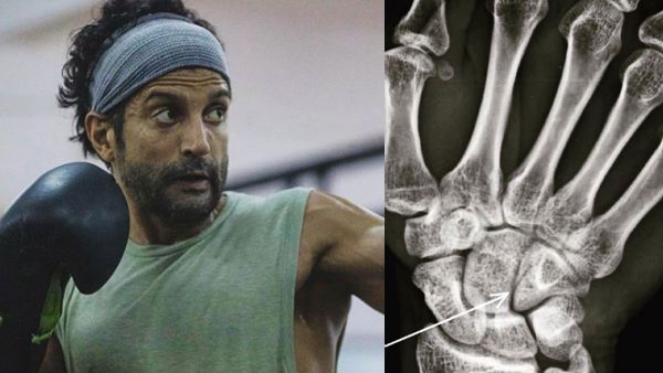 Farhan Akhtar Suffers Hairline Fracture While Shooting For Toofan; Shares X-Ray Image