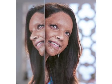 Deepika Padukone's Chhapaak: Official Trailer To Release On World Human Rights Day!