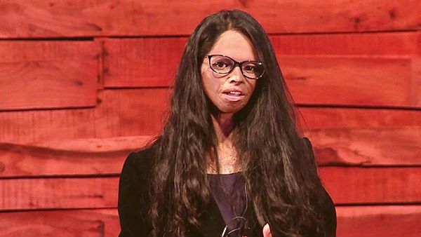 Why Did Laxmi Agarwal Skip Deepika Padukone's Chhapaak's Trailer Launch?