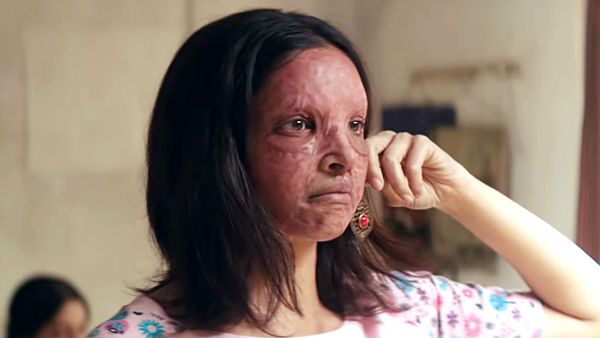 Meghna Gulzar ‘Found’ Malti In The First Prosthetics Session With Deepika Padukone: Chhapaak