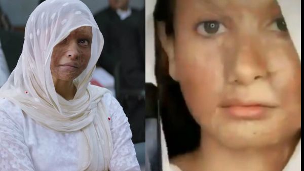 Deepika Padukone's TikTok Challenge On Chhapaak Look Backfires; Netizens Find It 'Demeaning'