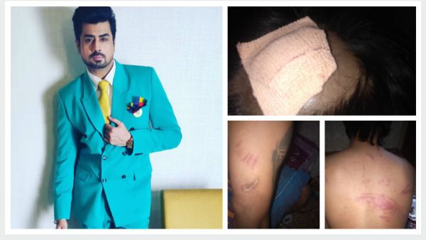 Ex Bigg Boss Contestant Pritam Singh Brutally Beaten Up By Goons When He Tried To Save A Woman