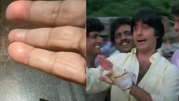When Amitabh Bachchan Burnt His Left Hand: 'Took Me Two Months To Move My Thumb To My Index Finger'