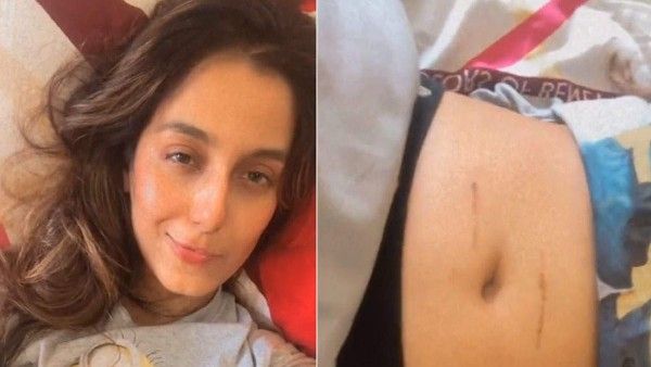 Bigg Boss 12 Fame Srishty Rode Discharged From Hospital After Surgery, Shows Her Belly Stitches