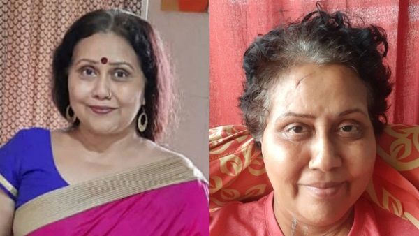 Varsha Dandale Meets With Major Accident; Says ‘I Am Bedridden & Don't Even Move From My Bed’