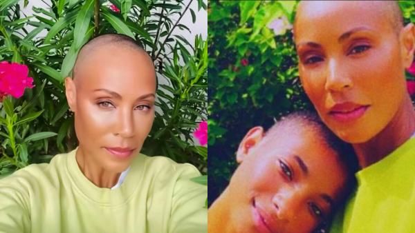 Jada Pinkett Smith Says She Is Going To Be Friends With Her Alopecia