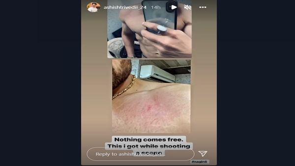 Tejasswi Prakash’s Naagin 6 Co-Star Ashish Trivedi Gets Injured While Shooting For Intense Scene