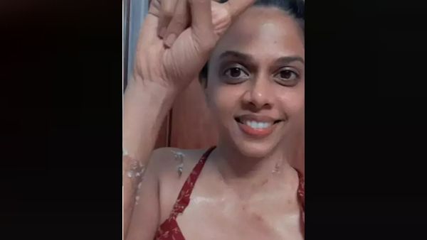 Rutuja Bagwe Had An Accident In Her Kitchen; Actress Says ‘She Is Healing’