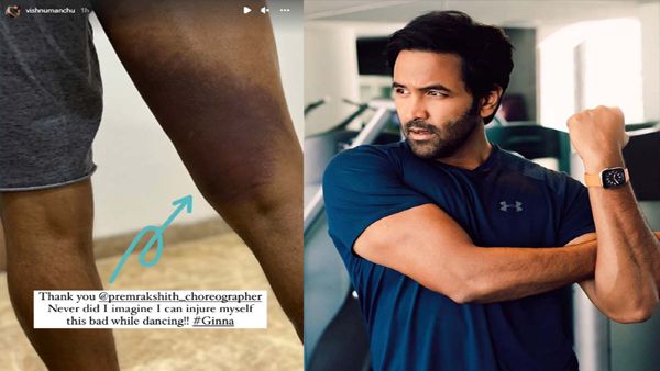 Manchu Vishnu Injures Leg Again, But This Time Due To Dancing!