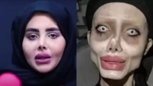 Iran's ‘Zombie Angelina Jolie', Sahar Tabar Reveals Viral Image Was Fake, Shows Her Real Face