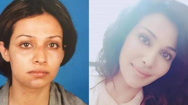 Exclusive! Flora Saini Recounts Brutal Domestic Violence Case: 'He Dragged Me By Hair On Streets'