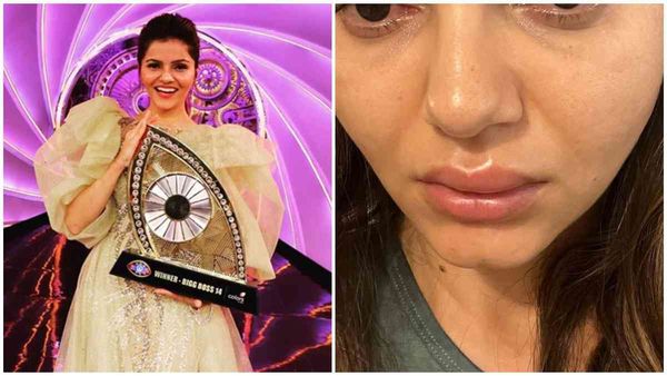 Bigg Boss 14 Winner Rubina Dilaik Shocks Fans By Sharing Pics With Swollen Lips: I Look Like Duck Without…