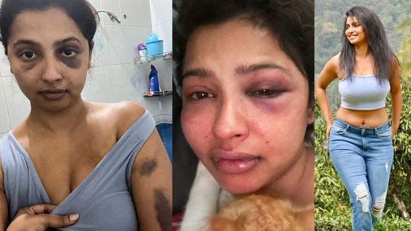 Anicka Vikhraman Breaks Silence On Alleged Abuse From Ex-Boyfriend; Reveals Shocking Details In A Note