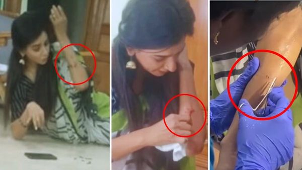 Baakiyalakshmi Jeni Injured During Shoot; Releases Behind The Scene Video As Proof
