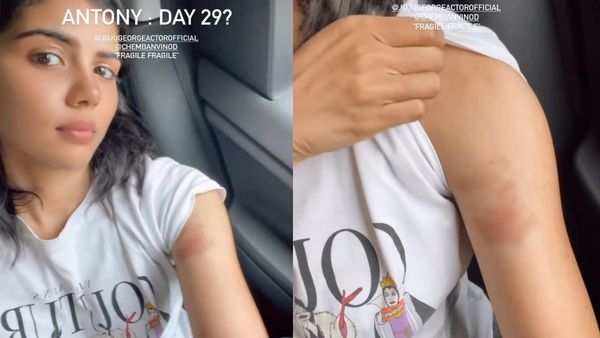 Actress Kalyani Priyadarshan Braves Bruises While Shooting Stunts For Joju George's 'Antony'