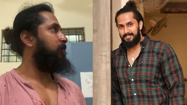 Kannada Actor Chetan Chandra Faces Brutal Attack Near Bengaluru, Sparks Social Media Outcry