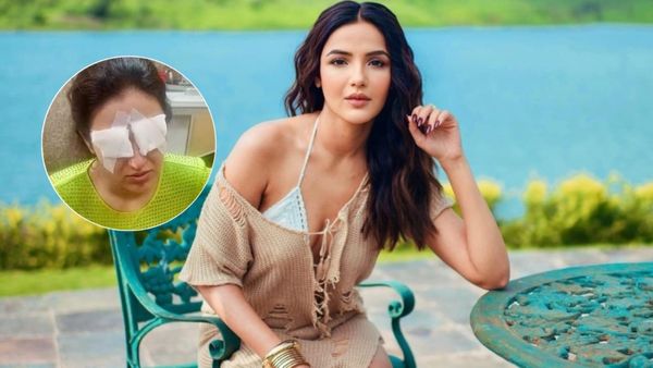 Jasmin Bhasin Suffers Corneal Damage Due To Lens Mishap? Actress Shares Update; '... I Can't See' | VIRAL Pics