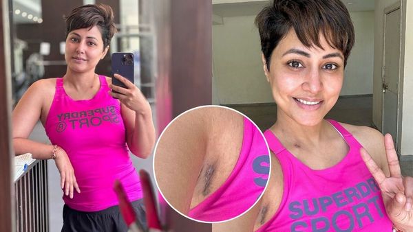 Hina Khan Health Update: Actress Flaunts Her Scars With Smile Amid Breast Cancer Battle; Asks 'What Do You...'