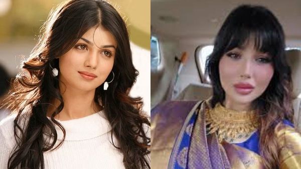 What Beauty Surgeries Did Ayesha Takia Undergo? Discover Real Reason Behind Actress Quitting Instagram