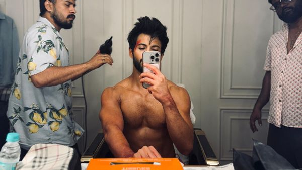 Rohit Saraf Teases NEW PROJECT, As He Looks Battered, Bruised And Bloodied!