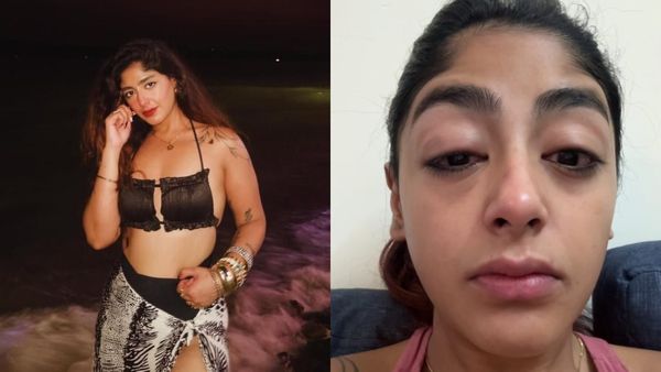 MTV Splitsvilla 16 Fame Preet Singh Assaulted By Influencer, Says 'I Was Hit So Badly...' - SHOCKING VIDEO
